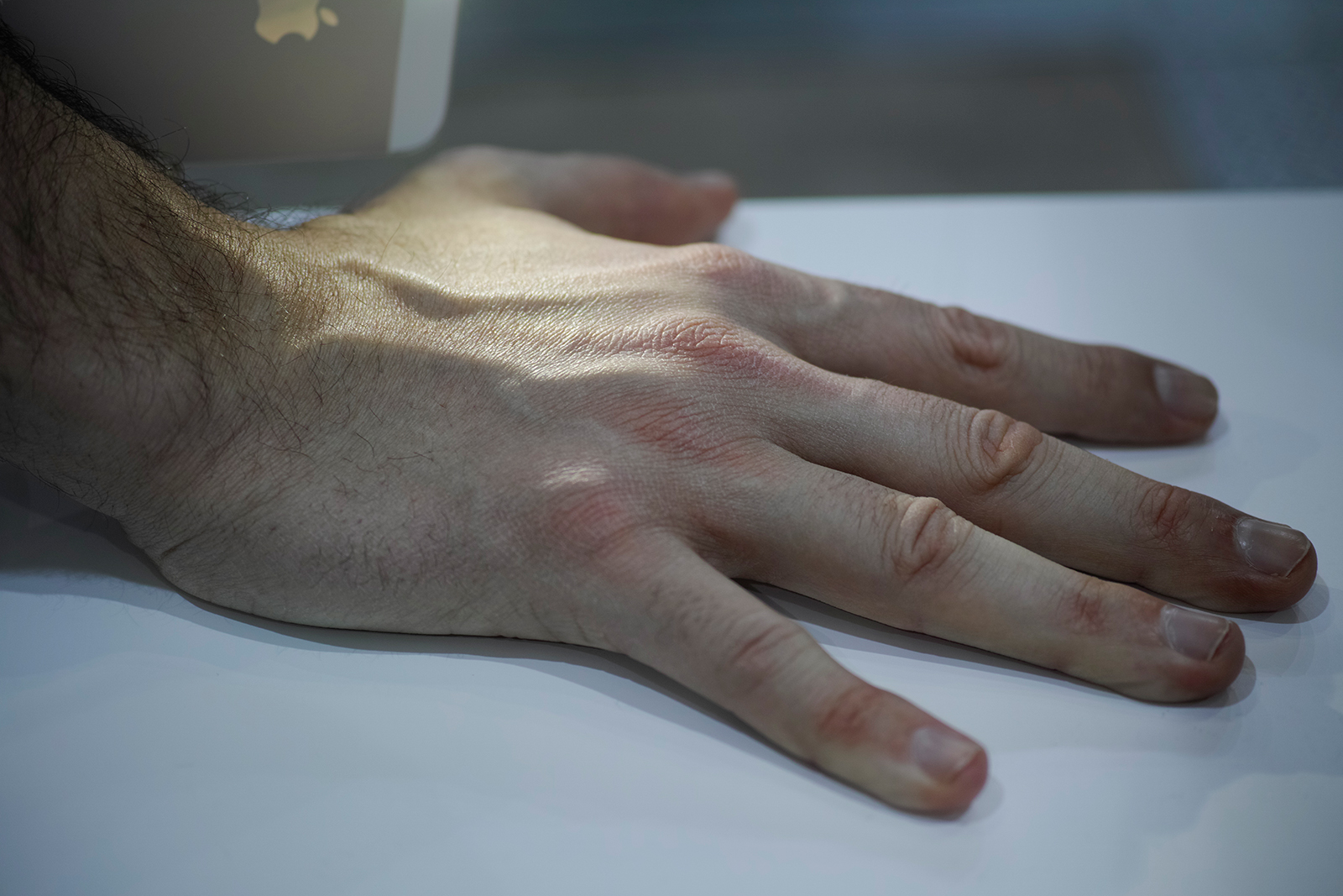 Fotografía de una mano apoyada, con gran detalle